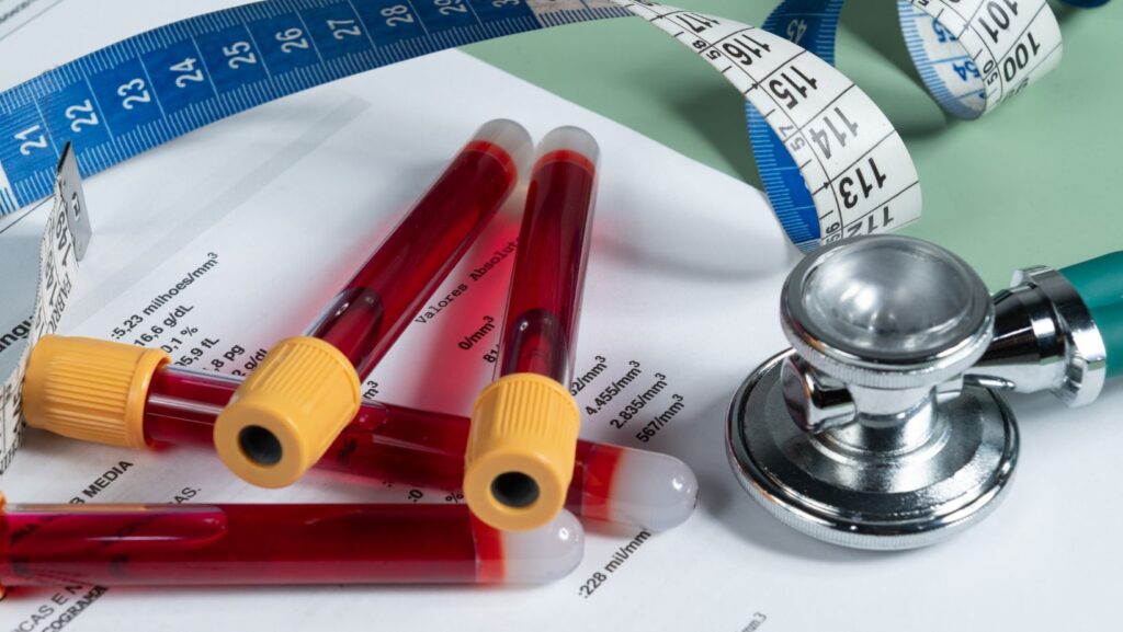 Kreatin bei metabolischem Syndrom